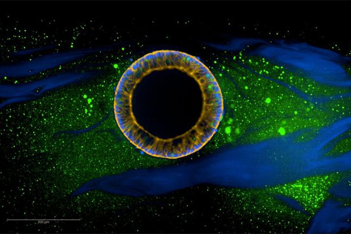 ©Leibniz IPF Dresden/Y.-H. Peng: Zyste aus humanen induzierten pluripotenten Stammzellen, die in synthetischen DNA-vernetzten Hydrogelen kultiviert wurden. Anfärbung: grün Zellen, gelb F-Actin, blau genomische DNA (in Zellkernen) und DNA-Quervernetzer (im Hydrogel) - konfokale Mikroskopie.